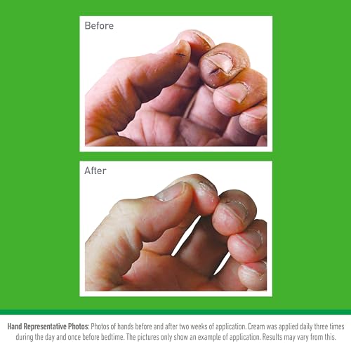 - O'Keeffe's Working Hands | 80ml Tube | Hand Cream for Extremely Dry, Cracked Hands -