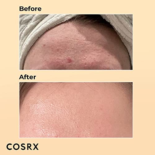 COSRX Advanced Snail 96 Mucin Power Essence 100ml, Skin Repair & Hydrating Serum, Snail Secretion Filtrate 96% & Hyaluronic acid, Korean Skincare, Animal testing free