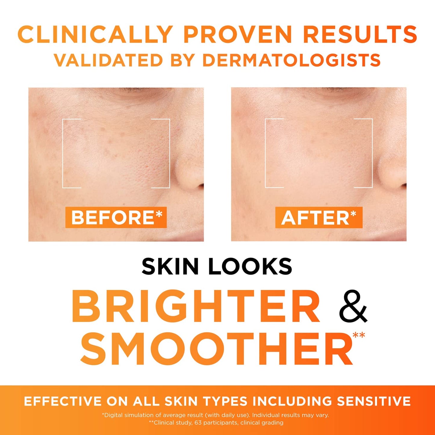 - L'Oréal Paris Revitalift | Pure Vitamin C Brightening Serum -