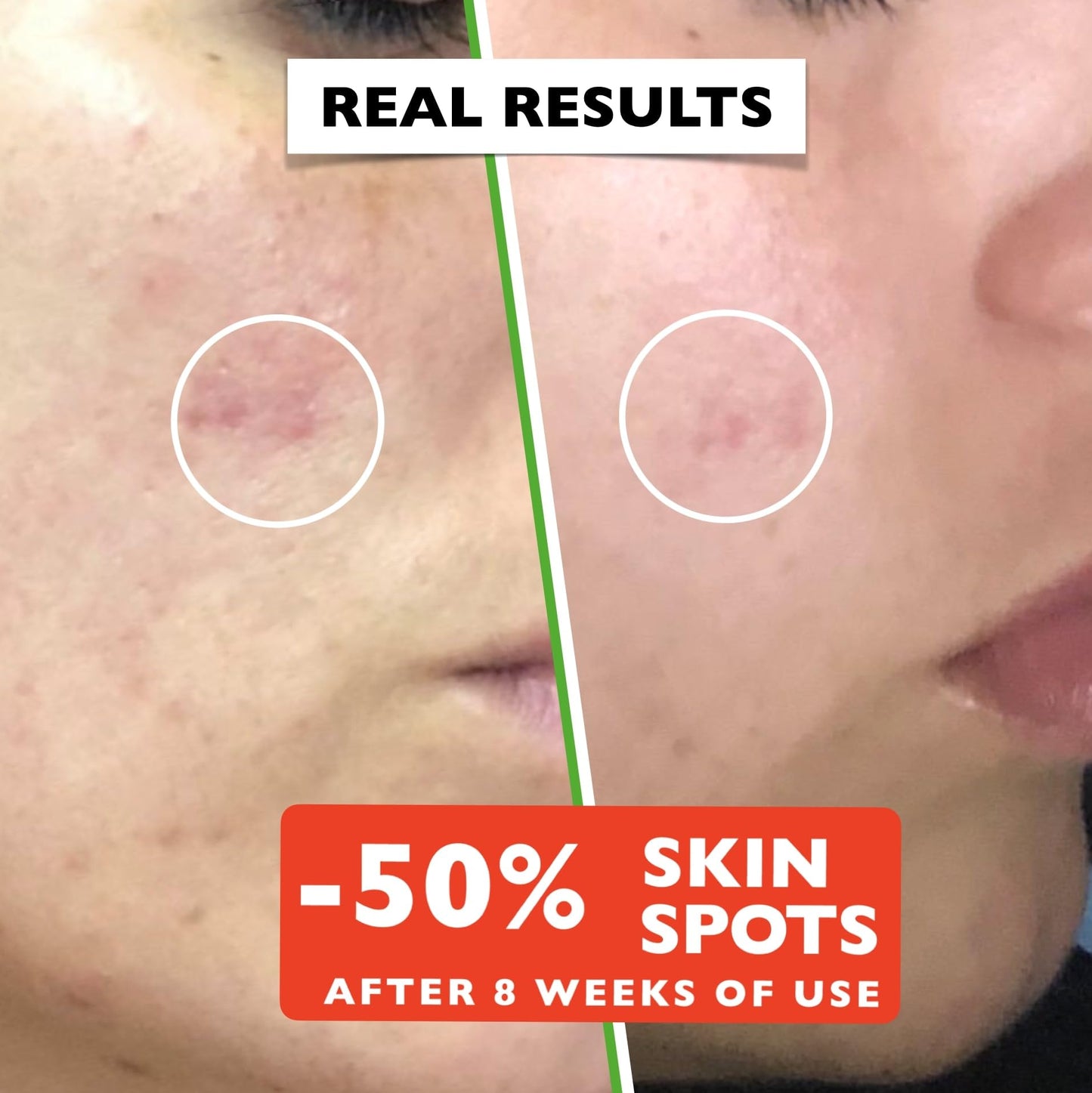 Big 2.11oz. Organic Vitamin C Serum for Face with Hyaluronic Acid. Anti-Aging, Wrinkles, Dark Spots, Brightening and Vegan. Facial Skin Care. Eye Cream Suitable. Women and Men