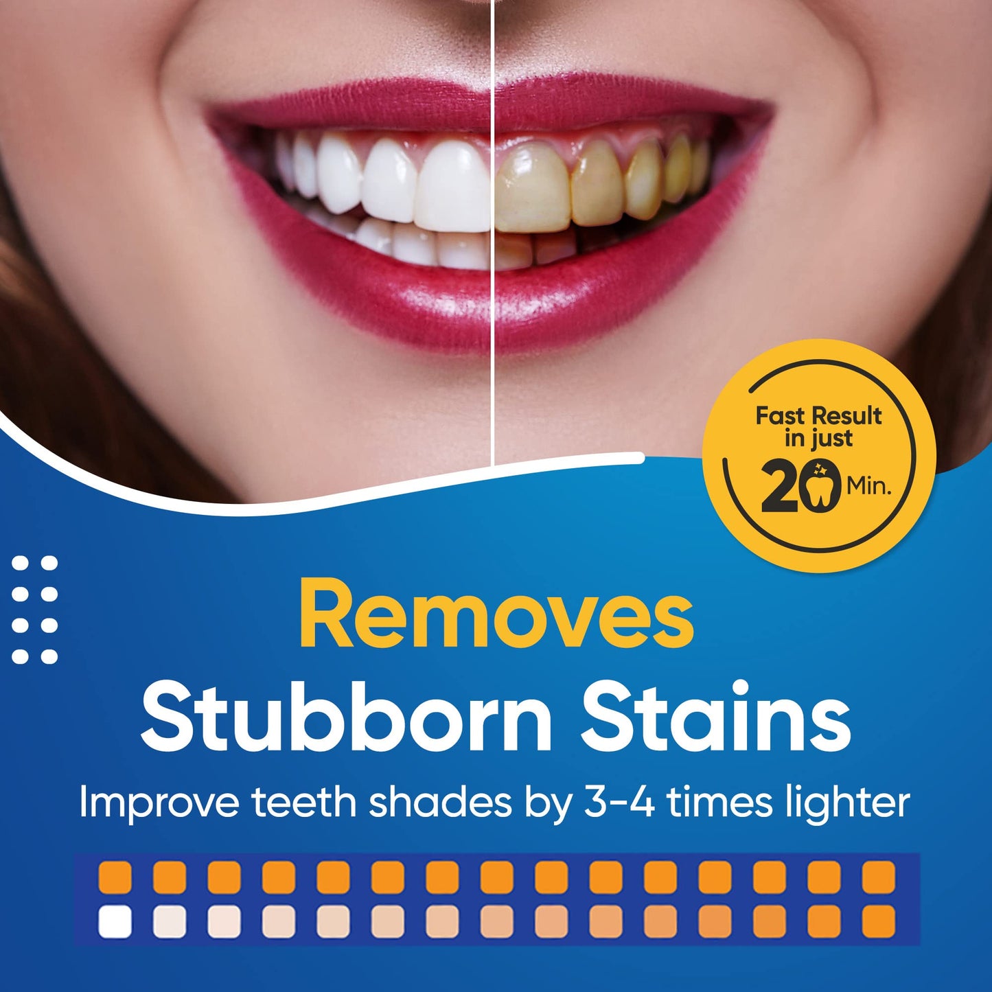 - Rebel Teeth Whitening Kit |Teeth Whitening Pen with Cool Blue LED Light -