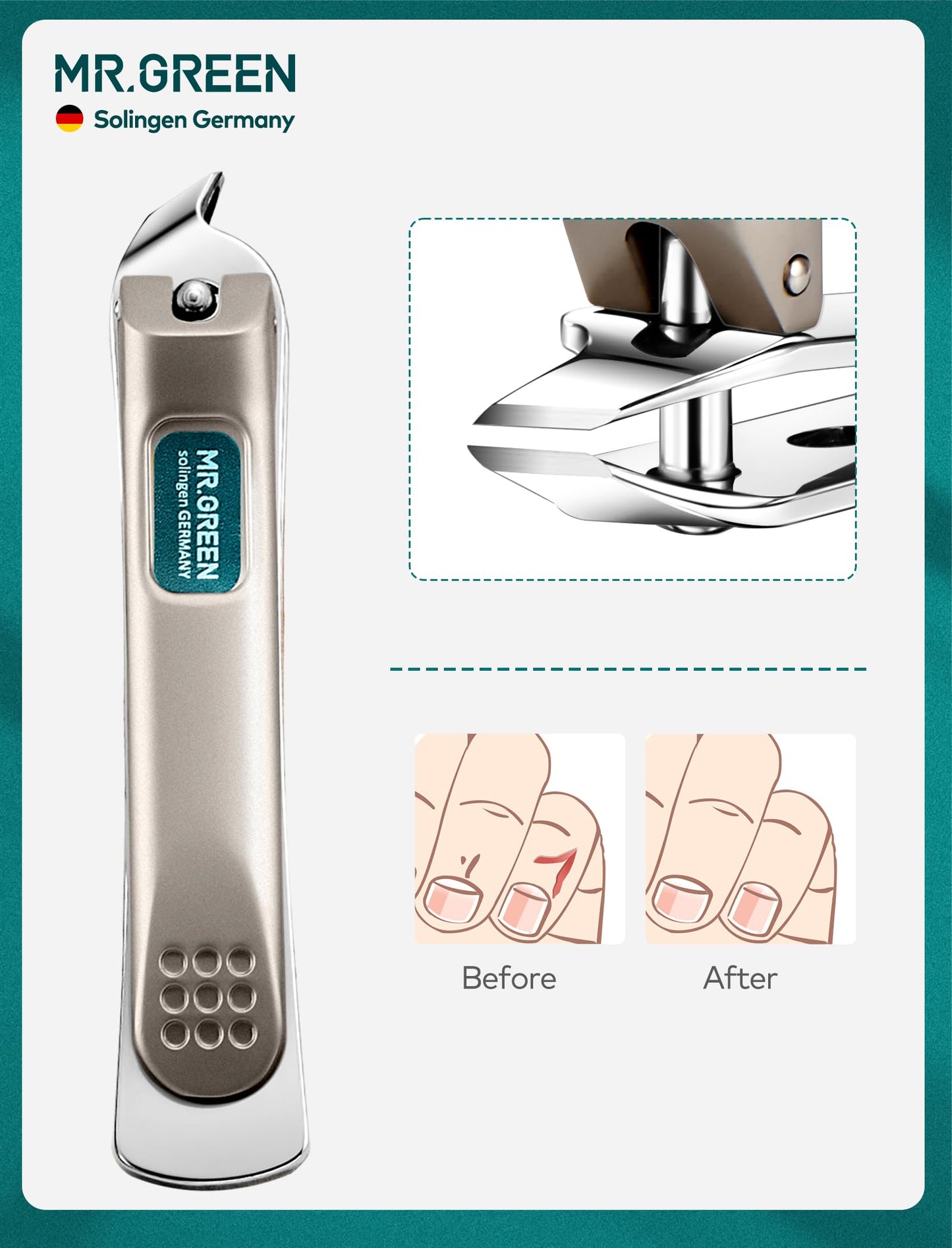 - Mr.Green Nail Clipper Gift Set | Stainless Steel Professional Nail Trimmers -