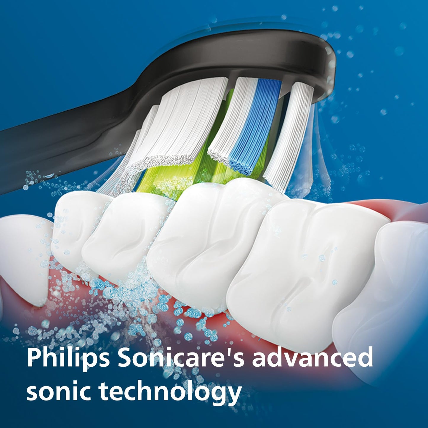 - Philips Sonicare ProtectiveClean 4300 | Sonic Electric Toothbrush with W2 Optimal White Toothbrush Head -