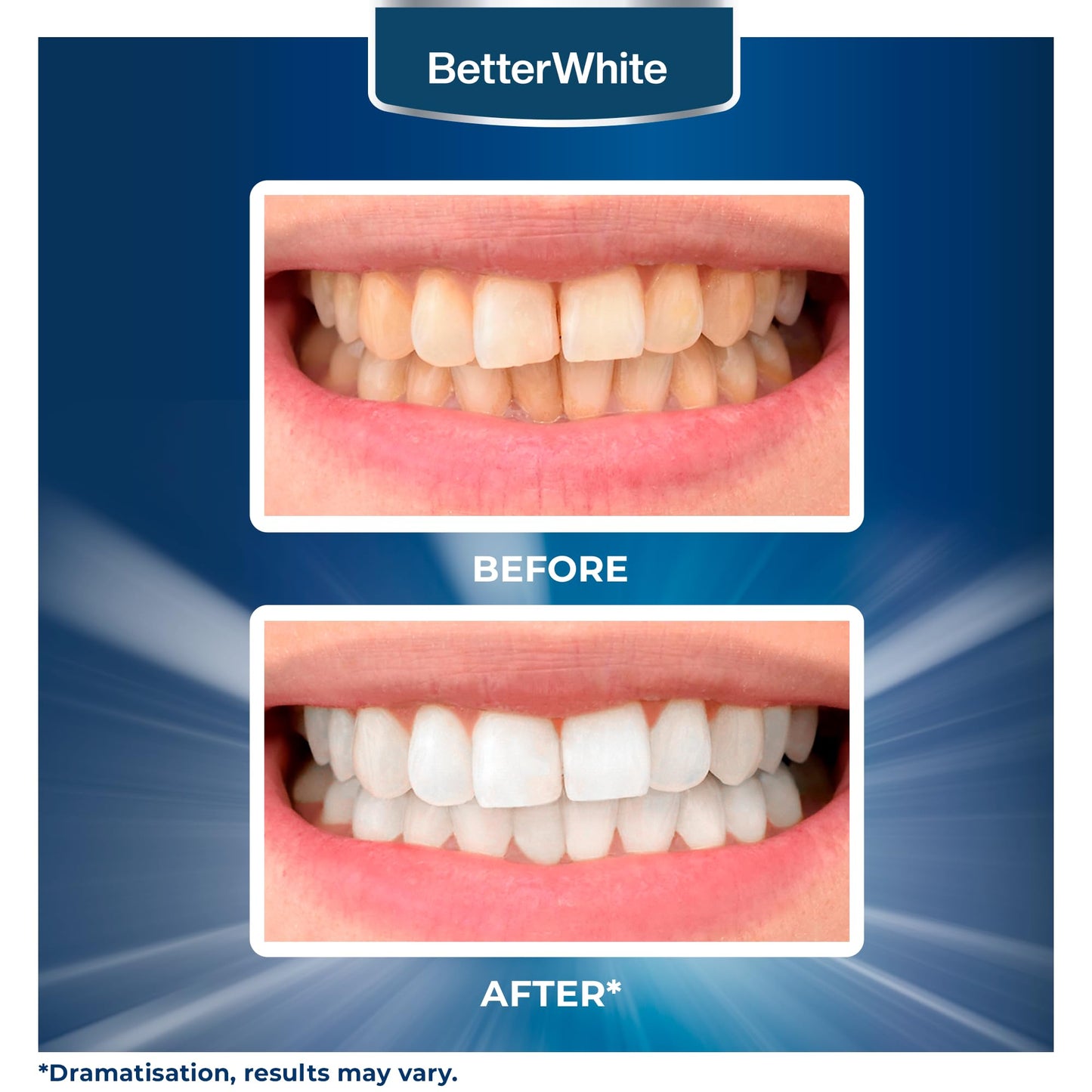 BetterWhite Professional Teeth Whitening Strips 21 Treatments - Enamel Safe - Non-Sensitive Formula - 42 Peroxide-Free Whitening Strips - Dentist Formulated Teeth Whitening Kit + Mouth Opener Included
