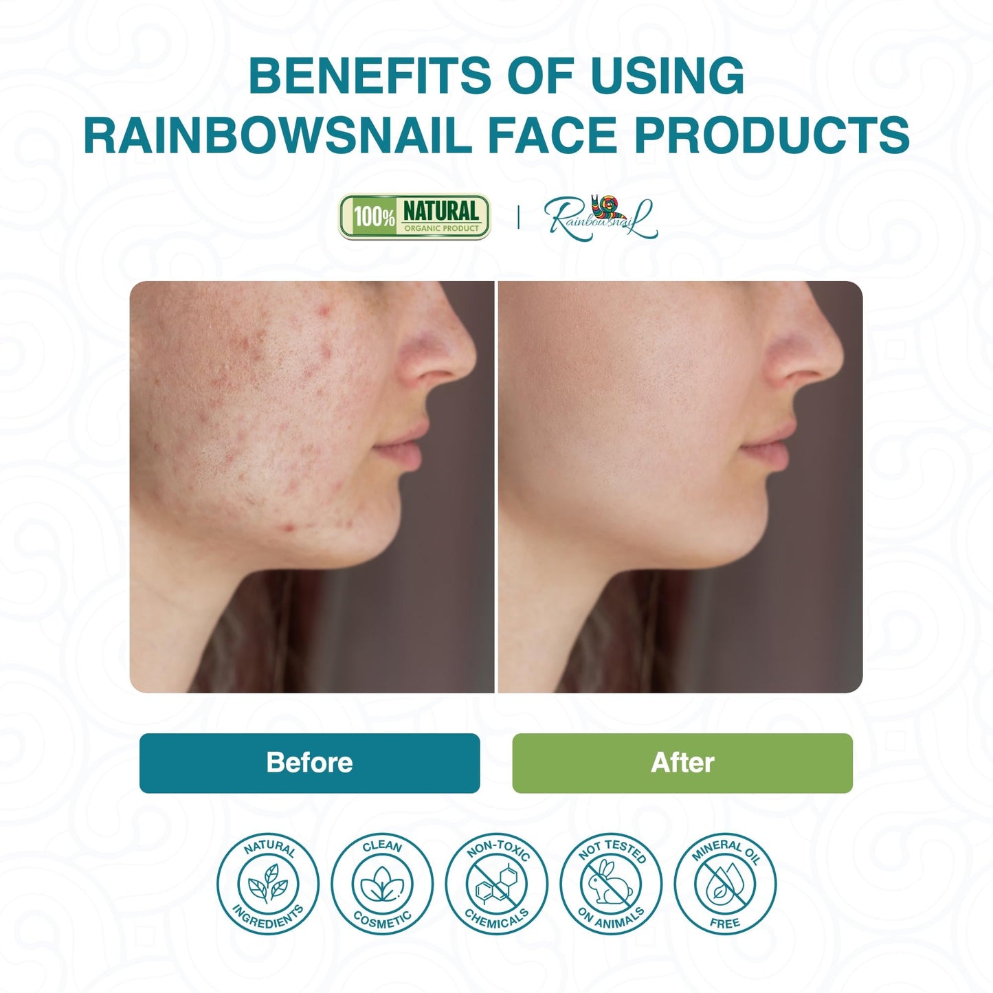 - RainbowSnail | Optimal Repair Serum  | Snail Serum -