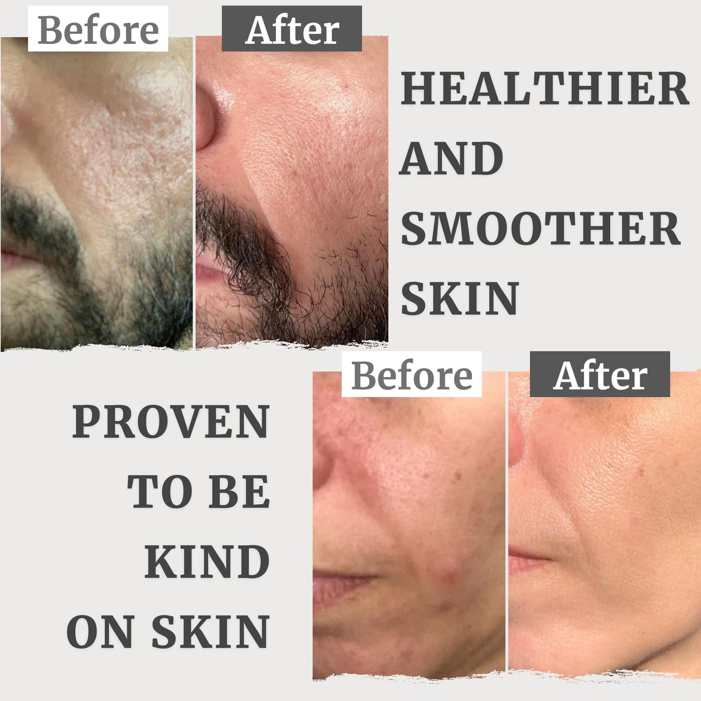 - Organic Face Cream & Face Moisturiser | Natural Moisturiser Face Women & Men | Anti Aging Face Cream -