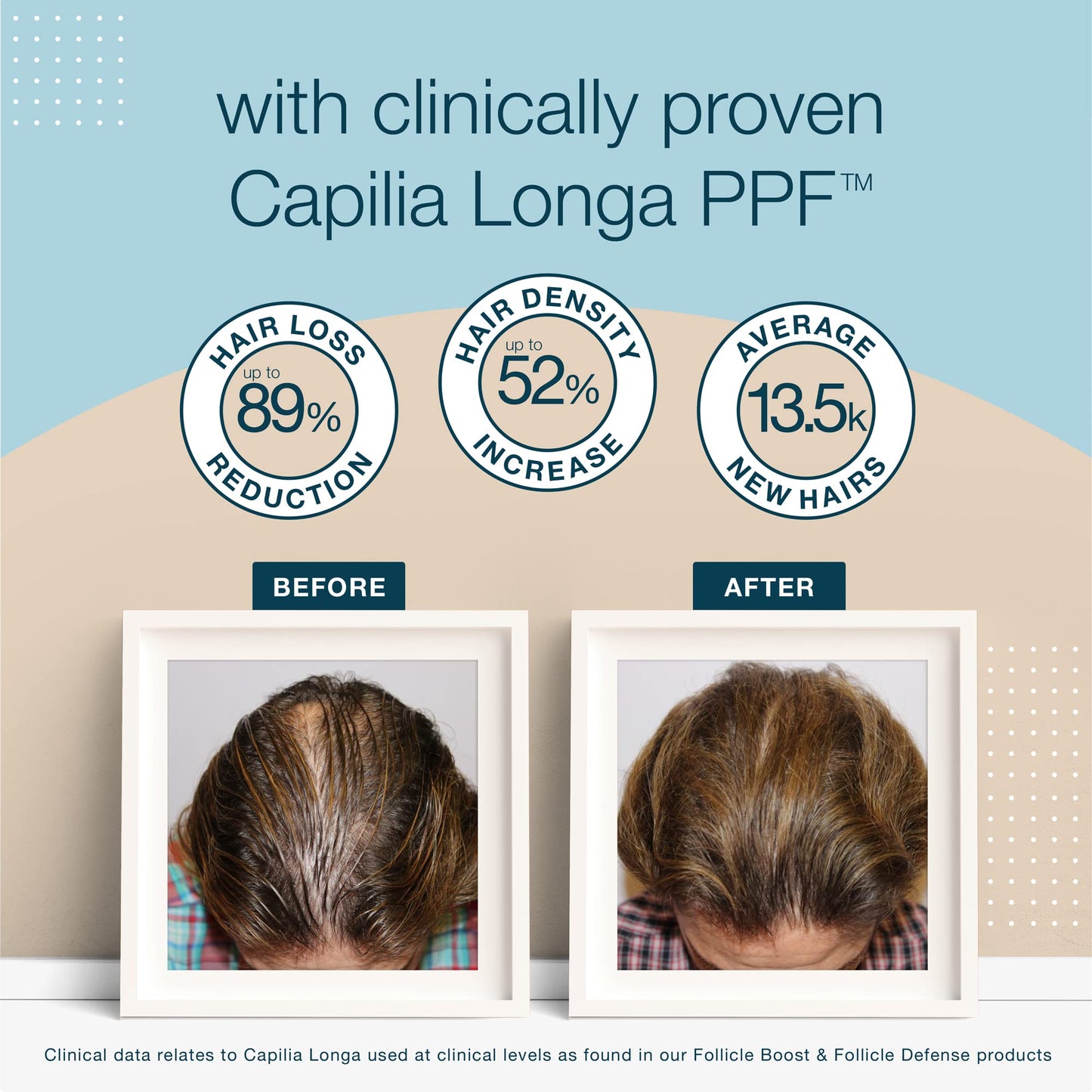 - Stemgro Trichology | Mens Hair Loss Shampoo and Conditioner | 2-in-1 | 300ml | Hair Growth Treatment for Men -