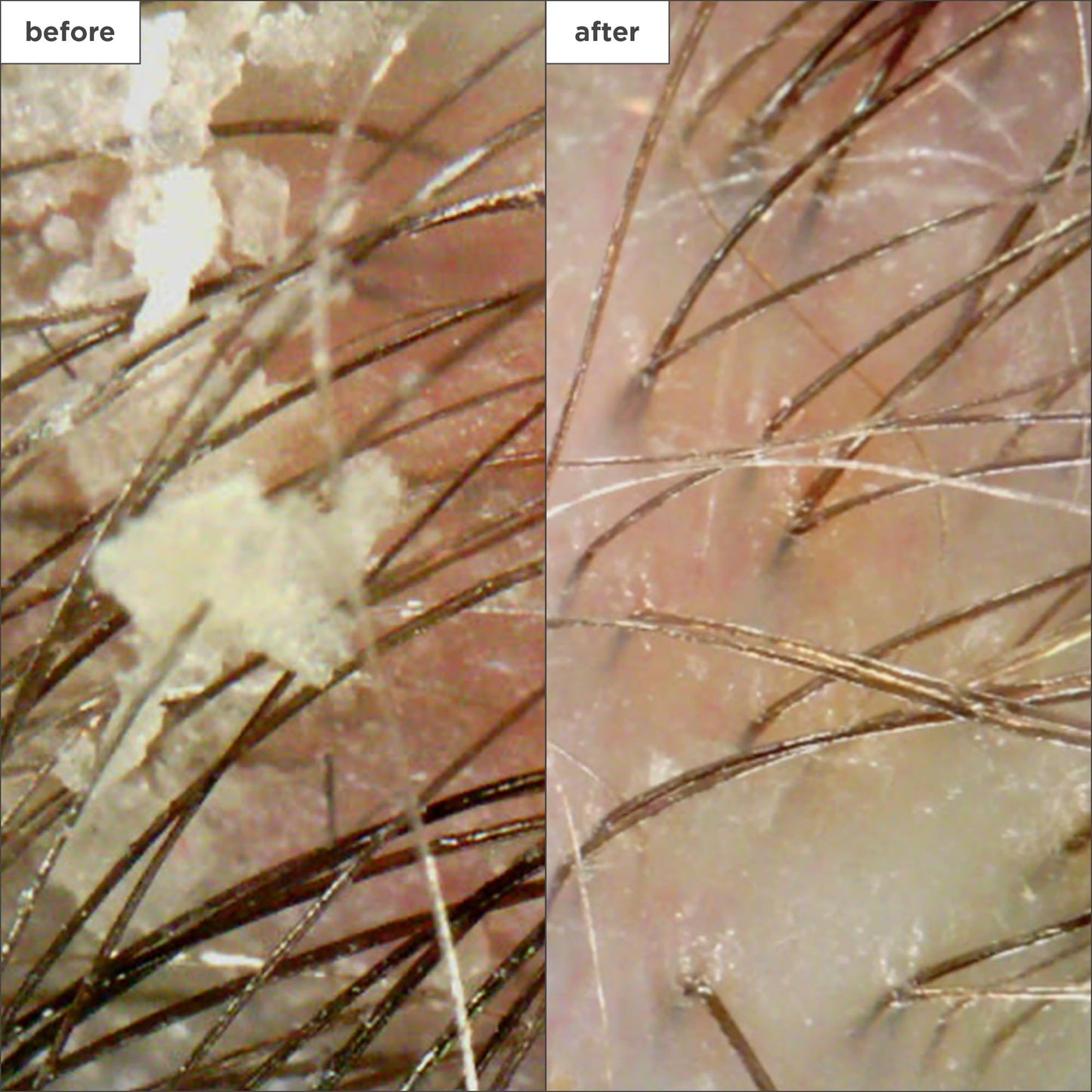 Briogeo Scalp Revival Charcoal + Coconut Oil Micro-Exfoliating Shampoo | Scalp Scrub Treatment to Soothe a Dry, Flaky, Itchy Scalp | Vegan, Phalate & Paraben-Free | 236ml