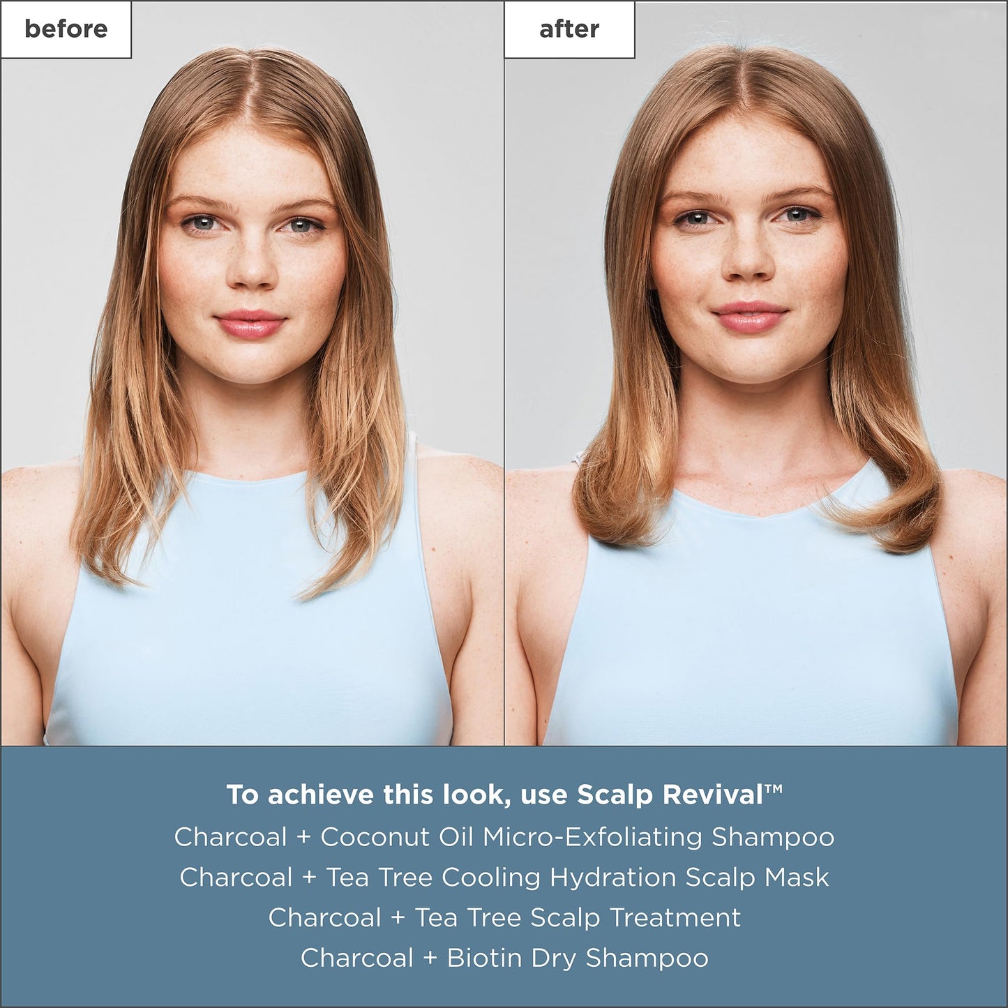 Briogeo Scalp Revival Charcoal + Tea Tree Cooling Hydration Scalp Mask | Dry Scalp Treatment and Moisturizer | Soothes a Dry, Flaky, Itchy Scalp | 177ml