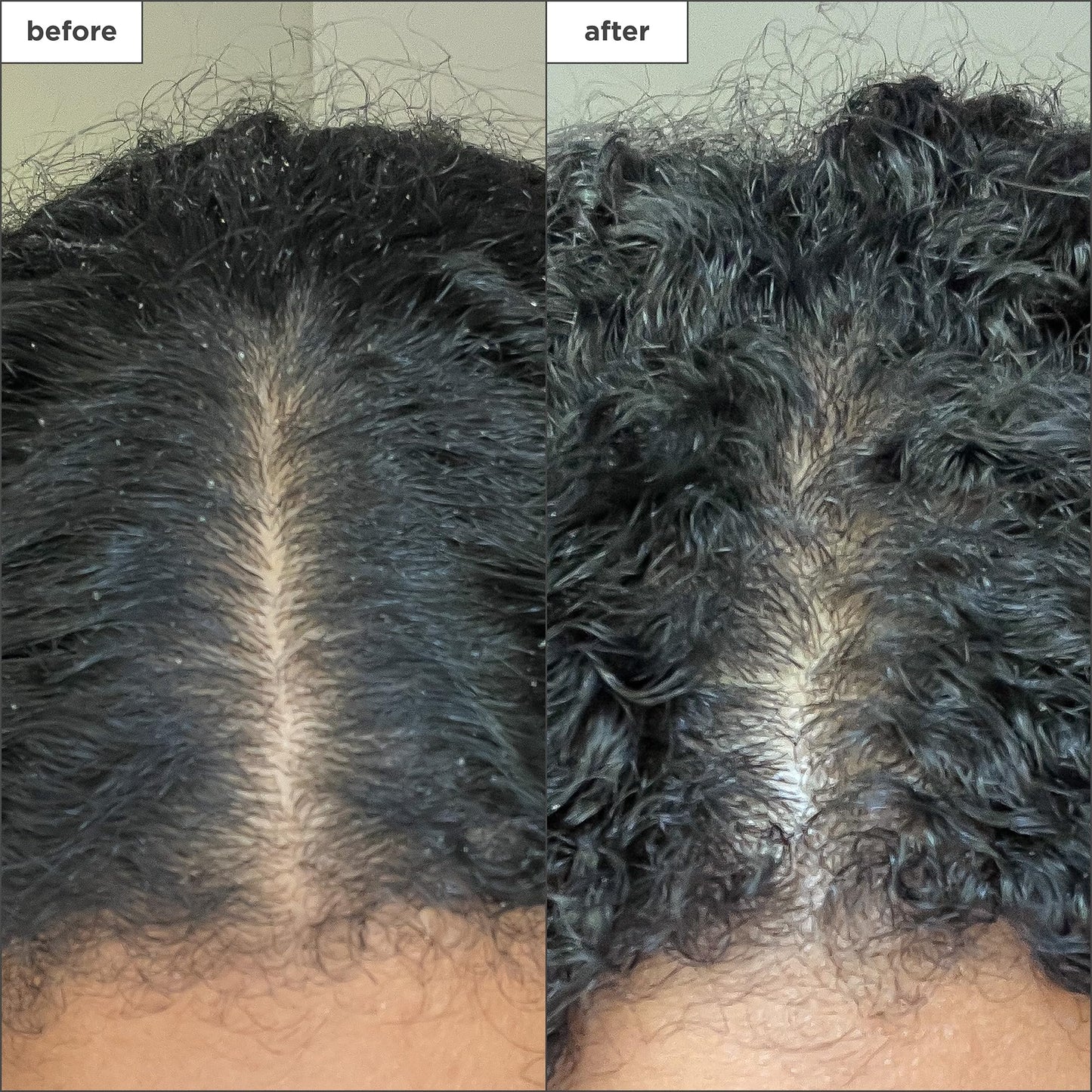 Briogeo Scalp Revival Charcoal + Coconut Oil Micro-Exfoliating Shampoo | Scalp Scrub Treatment to Soothe a Dry, Flaky, Itchy Scalp | Vegan, Phalate & Paraben-Free | 236ml