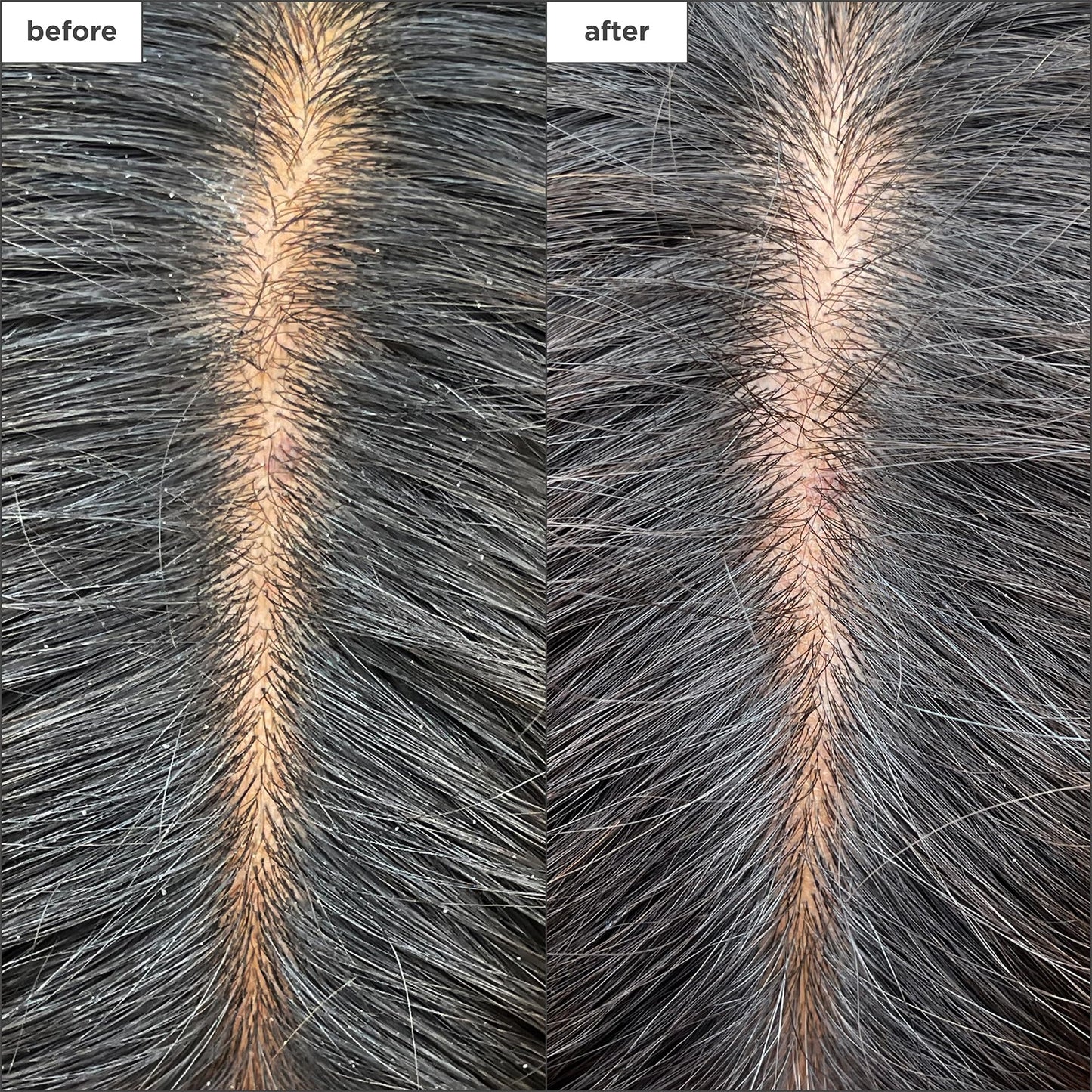 Briogeo Scalp Revival Charcoal + Tea Tree Cooling Hydration Scalp Mask | Dry Scalp Treatment and Moisturizer | Soothes a Dry, Flaky, Itchy Scalp | 177ml