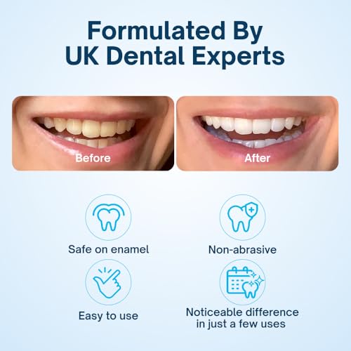 - MySweetSmile | Dentist-Approved Teeth Whitening Powder -