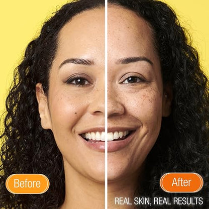 - Super Facialist | Vitamin C + Brighten Skin Renew Cleansing Oil | Face Cleanser for Dissolving Makeup -