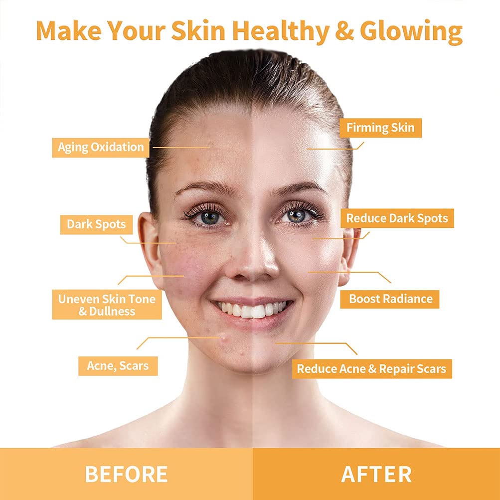 ANAiRUi Turmeric Vitamin C Face Mask with Turmeric and Kaolin Clay - Clay Mask for Radiant Skin, Oil Balance, Cleansing Pores - Beauty Face Mask, Skincare, 120g