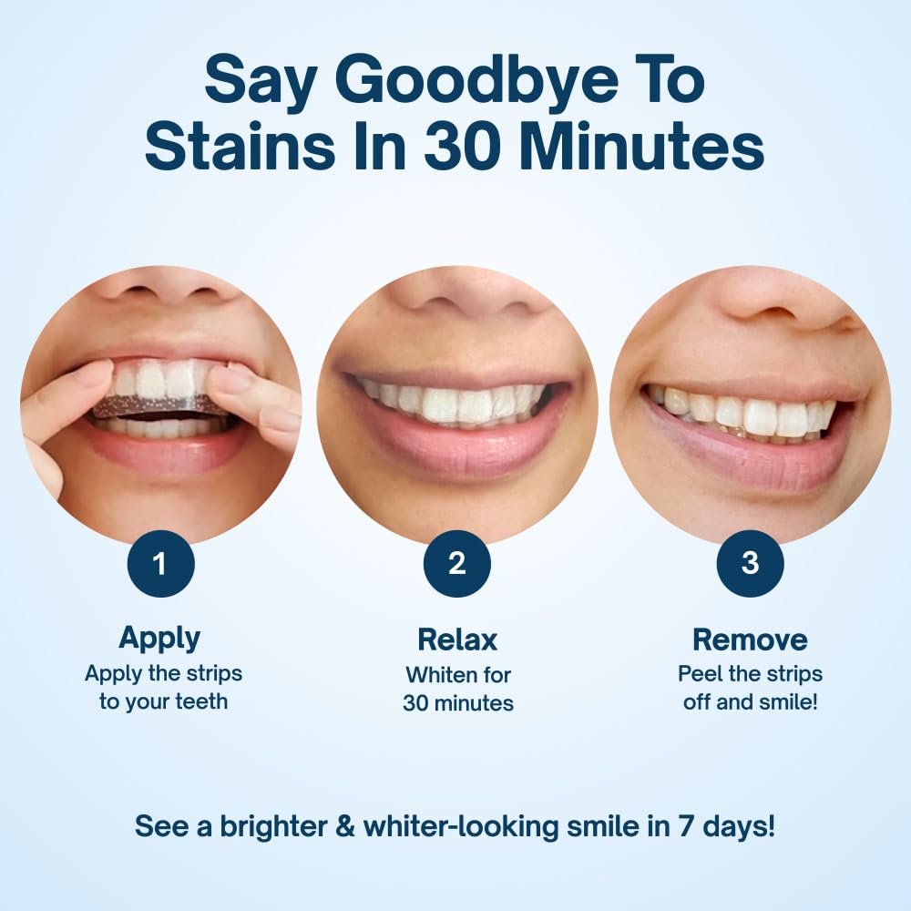 - MySweetSmile | PAP Teeth Whitening Strips | Enamel-Safe | Sensitivity-Free Formula -
