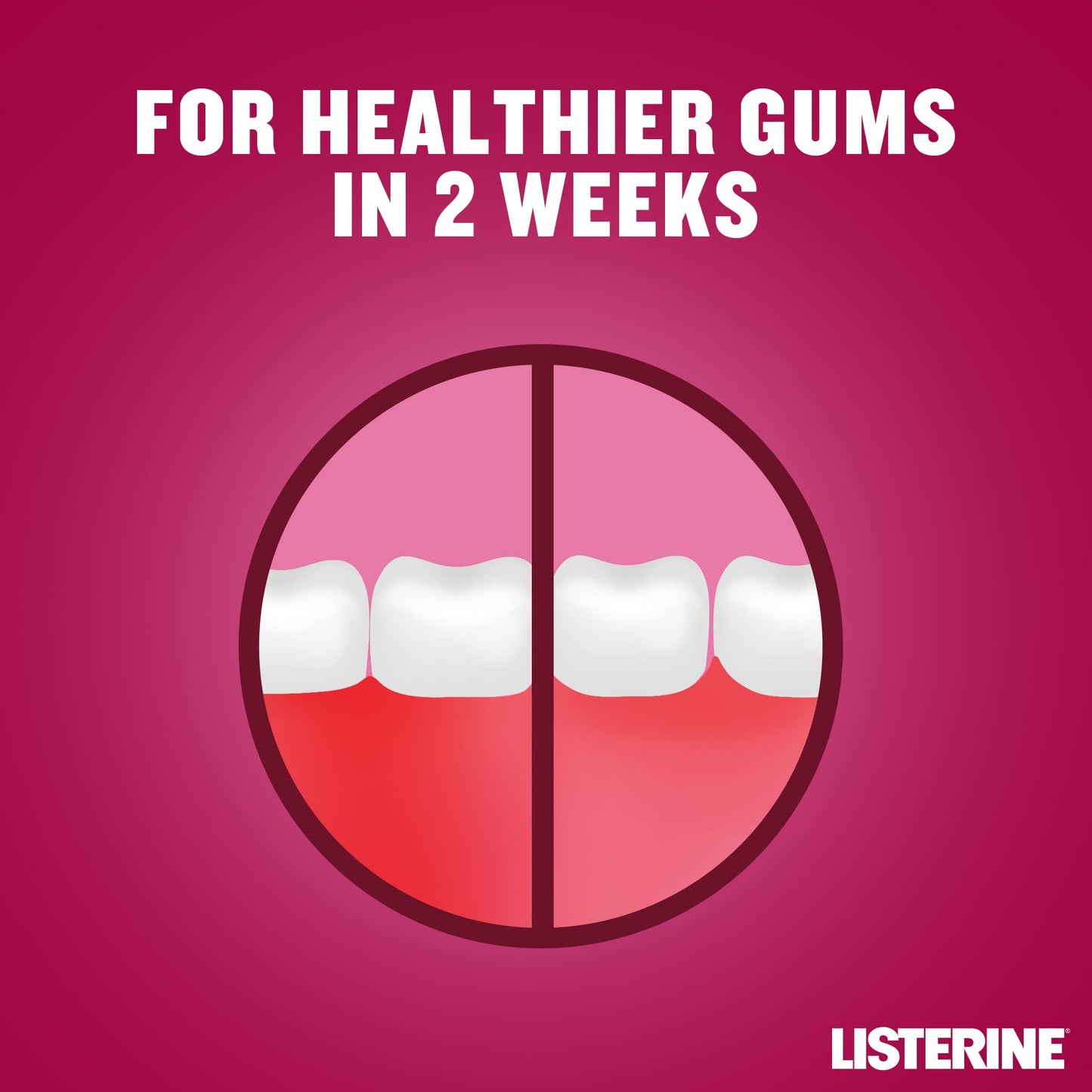 - Listerine Advanced Defence Gum Treatment Mouthwash | Clinically Proven -