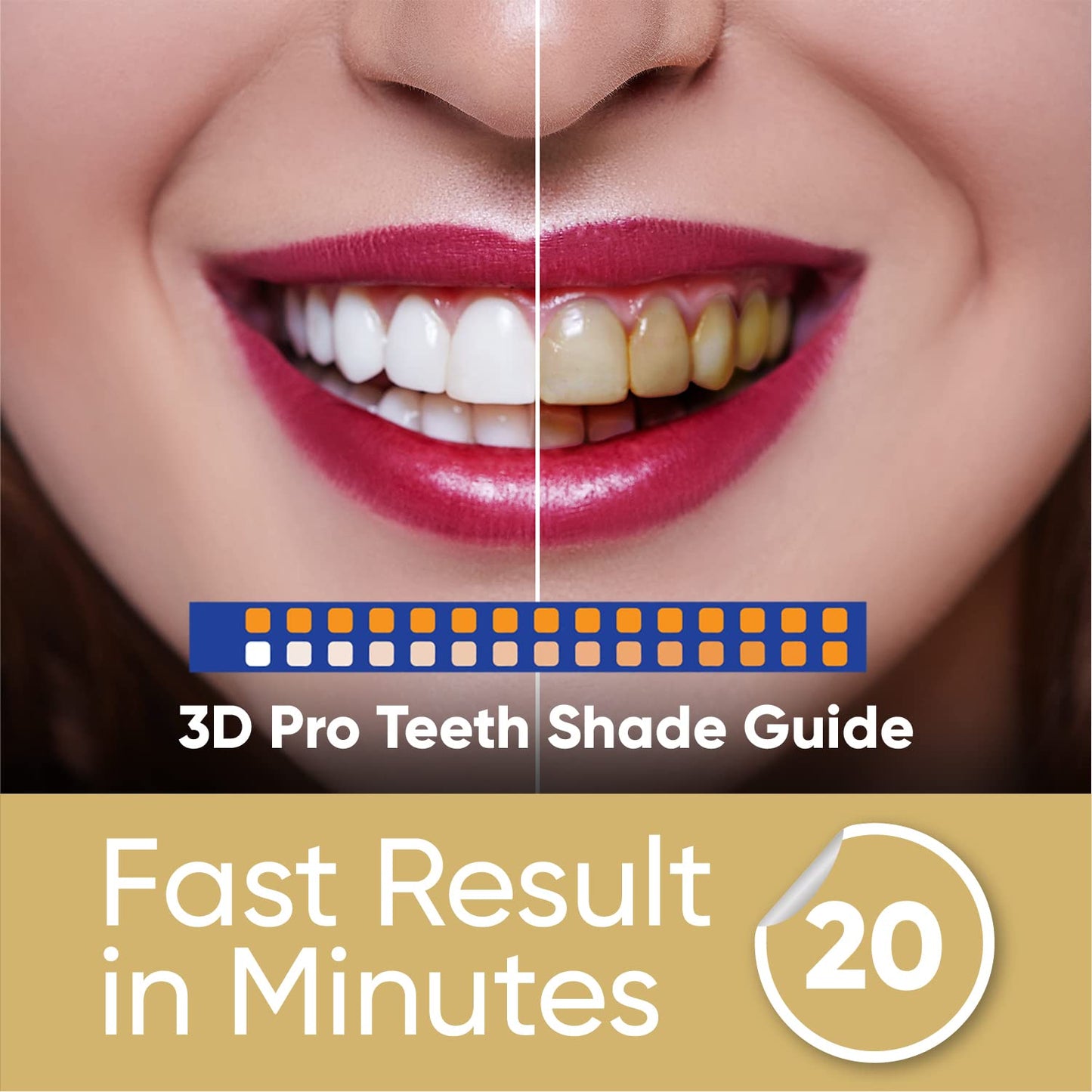 - Elite Professional LED Teeth Whitening Kit -