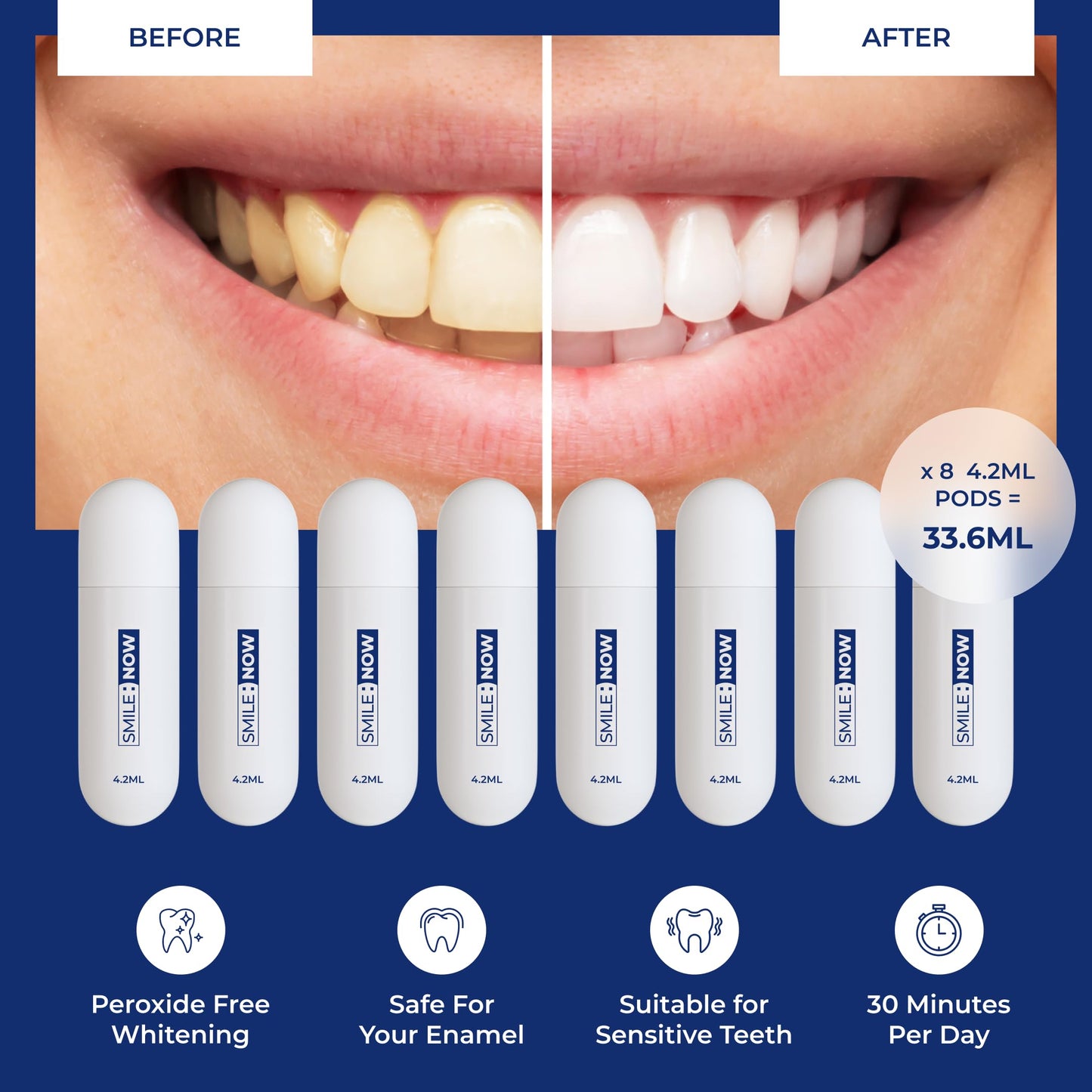 - Teeth Whitening Kit  | 8 Teeth Whitening Gel Pods 33.6ml | hi vis Smile Teeth Whitening Gel -