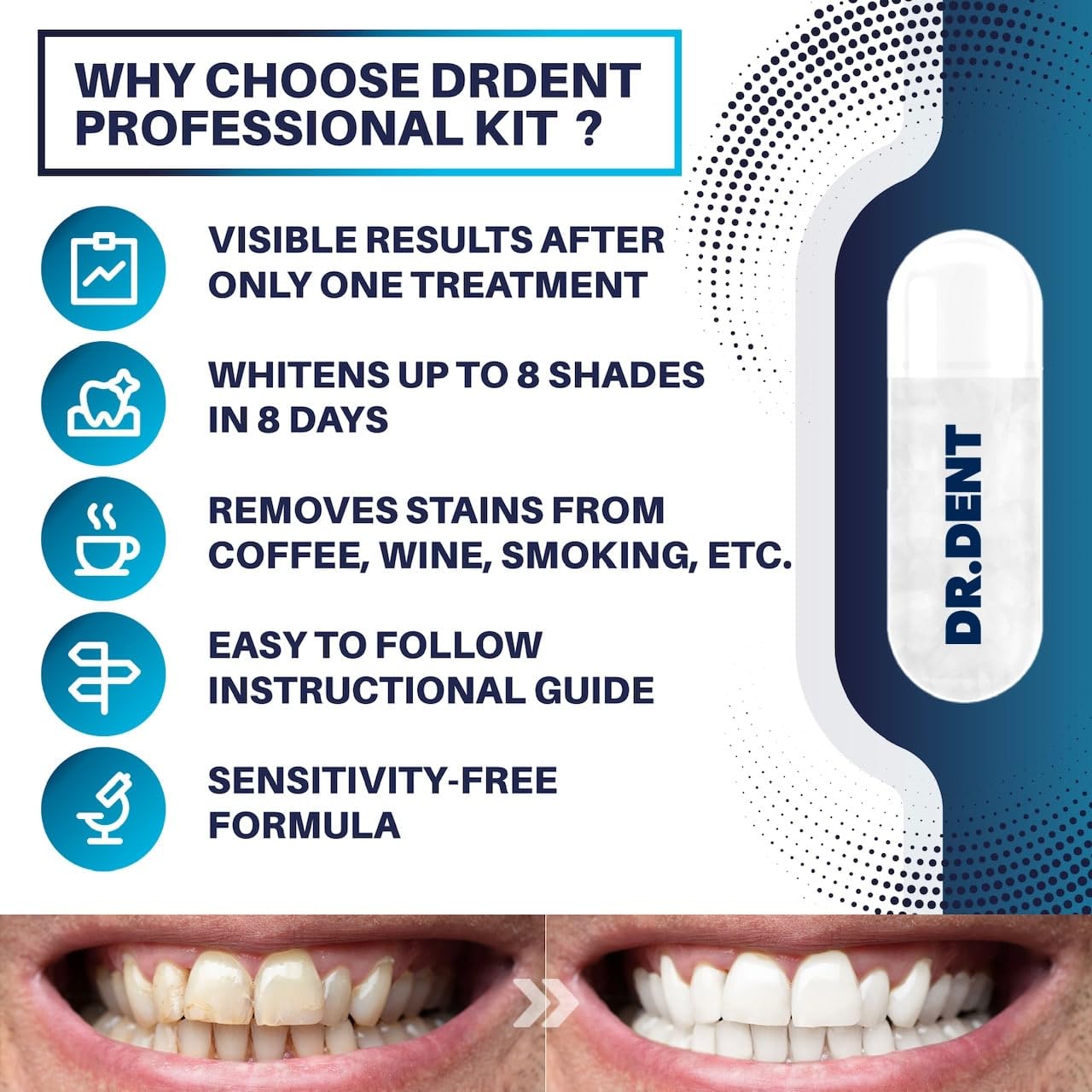 - DRDENT Professional LED Teeth Whitening Kit | Sensitivity Free Formula | 8 Teeth Whitening Gel Pods 33.6ml -