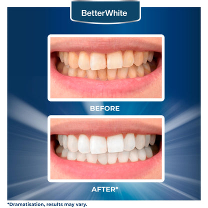 BetterWhite Professional Teeth Whitening Strips 21 Treatments - Enamel Safe - Non-Sensitive Formula - 42 Peroxide-Free Whitening Strips - Dentist Formulated Teeth Whitening Kit + Mouth Opener Included