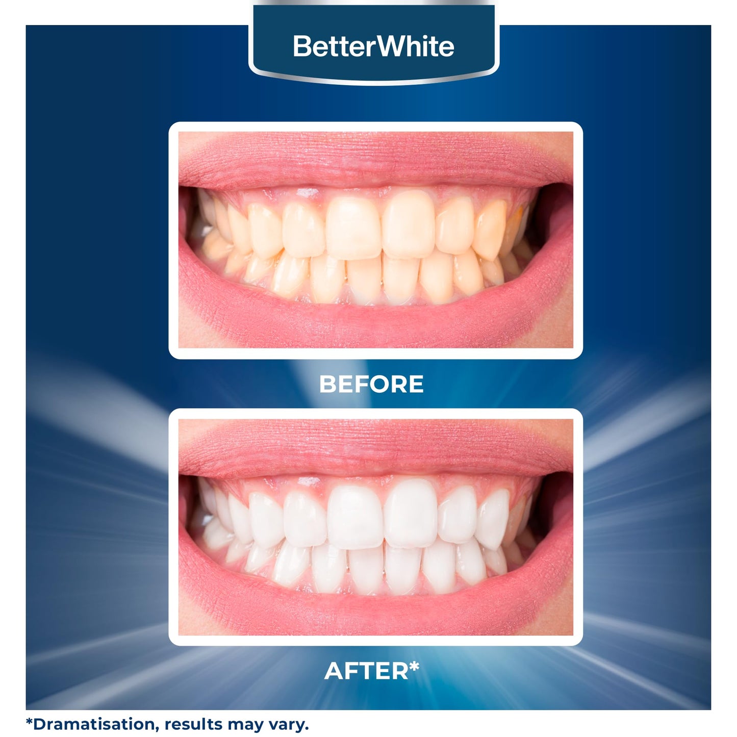 BetterWhite Teeth Whitening Powder - Dentist-Approved & Enamel-Safe | 6 Month Supply | Tea, Coffee, Wine & Smoking Stain Remover | Non-Sensitive Formula | Peroxide-Free | HAP, Baking Soda & Xylitol