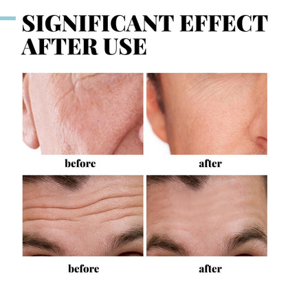 Anti-aging Cream for Men,Anti Wrinkle Cream for Men,Men's Anti-Aging Anti-Wrinkle Cream,Facial Cream Moisturiser for Men,Skin Firming And Tightening Anti Aging Wrinkle Cream For Men