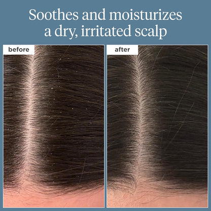 Briogeo Scalp Revival Rosemary Pre-Wash Oil for Hair and Scalp, Dry Scalp Treatment, 100ml