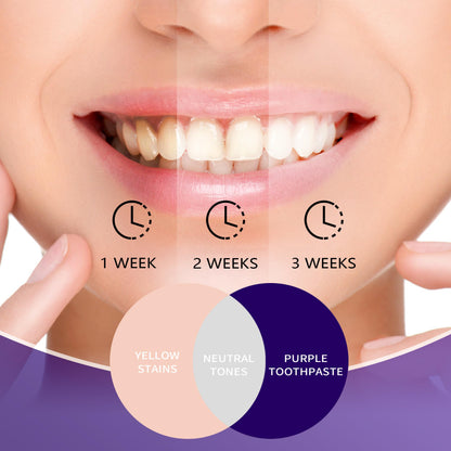 -  Purple Toothpaste for Teeth Whitening | For Sensitive Teeth | Colour Correcting Teeth Whitening Toothpaste -