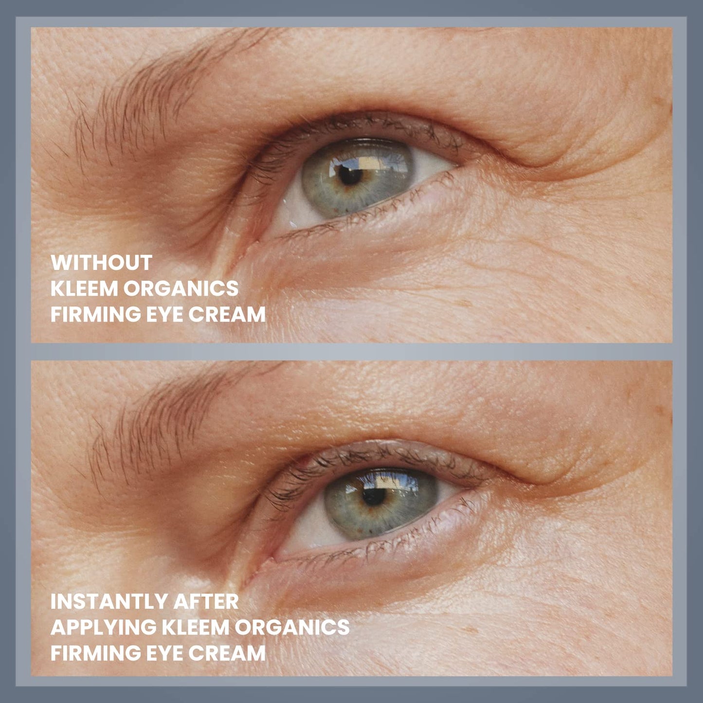 Anti Wrinkle Eye Cream for Dark Circles & Puffy eyes with Peptides and Niacinamide that Reduces Eye Bags, Crow's Feet, Fine Lines & Sagginess - Natural & Organic Under Eye Cream for Wrinkles - 15ml