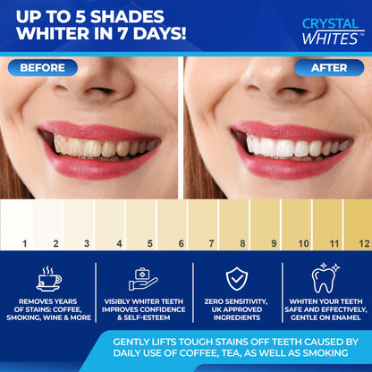 - Teeth Whitening Kit & Whitening Strips | LED Light Activator | 50 Whitening Sessions | 8X3ml Gels | Crystal Strips -