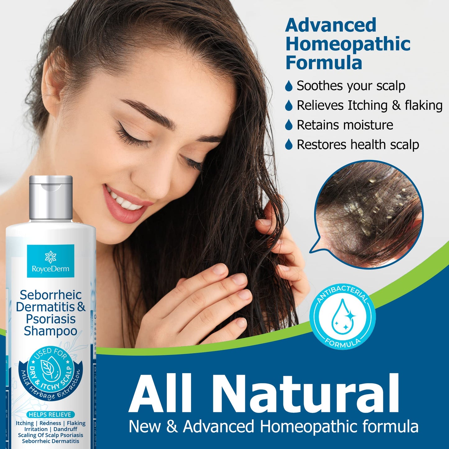 - Roycederm Seborrheic Dermatitis Shampoo | Psoriasis Shampoo | Dandruff Shampoo | Folliculitis Shampoo & Scalp psoriasis Treatment -