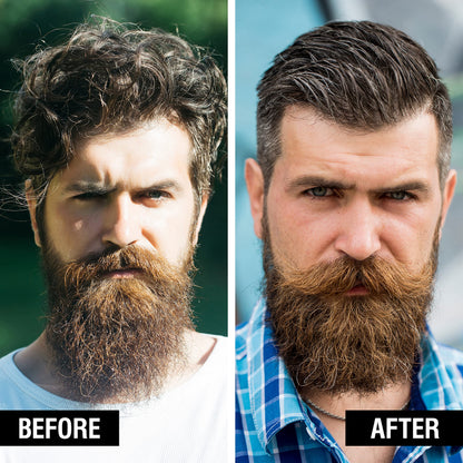 Beard Club - Beard Balm - Beard Wax - Beard Balm for Men - Beard Moisturiser - Beard Butter - Beard Cream - Beard Softener for Men - Beard Conditioner for Men - Beard Wax for Men - Cedar Wood and Lime